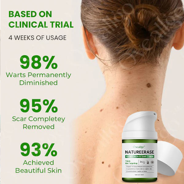 ✅ Official Store: Oveallgo® NatureErase Instant Alligator Oil Mole & Spot Cream