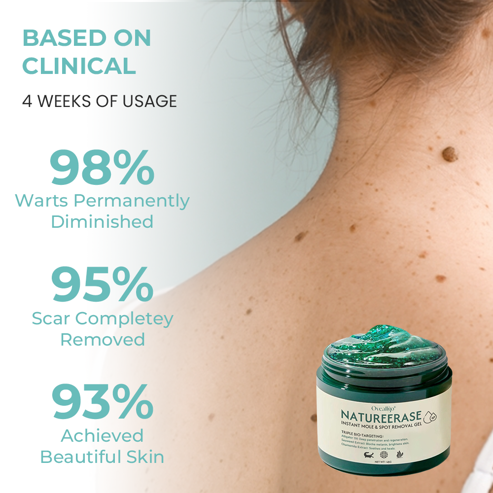✅ Official Store: Oveallgo® NatureErase Instant Alligator Oil Mole & Spot Removal Premium Gel