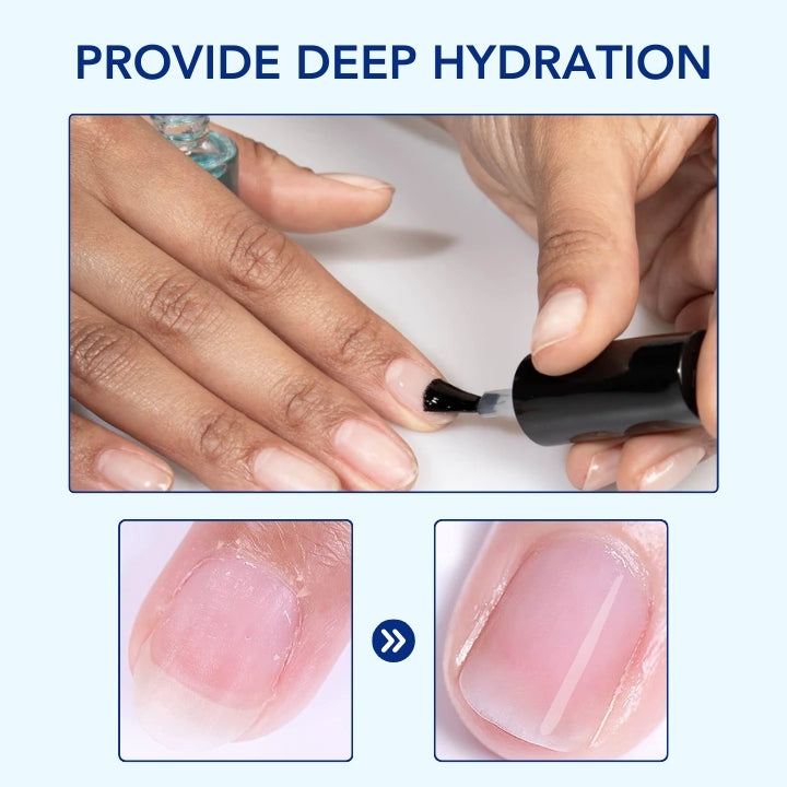 Fivfivgo® OnyxoGuard Nail Growth and Repair Serum