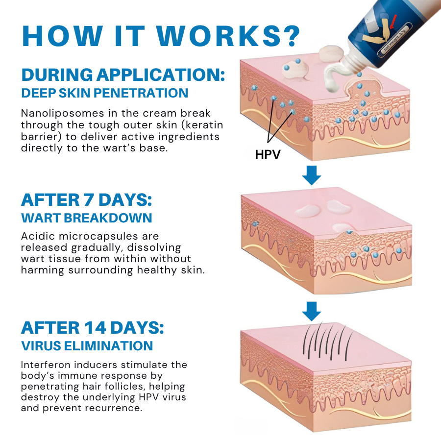 Fivfivgo® NEW HPV Genital Warts Relief Cream