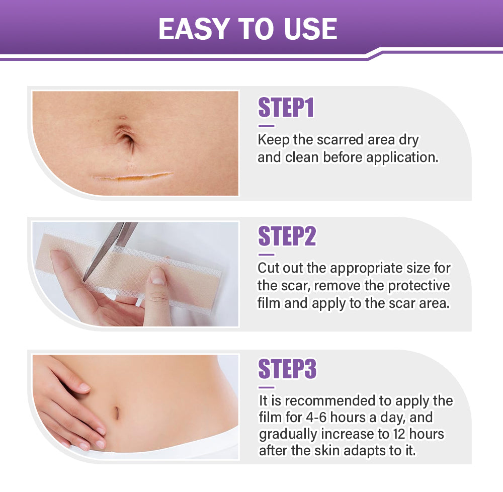 ✅Official Store | Oveallgo® Hyaluronic Acid Nano Microneedle Repair Tape🏥(Treatment of old and new scars, reduction of surgical scars, stretch marks, keloids, acne, burns, warts, dermatomes and varicose veins)
