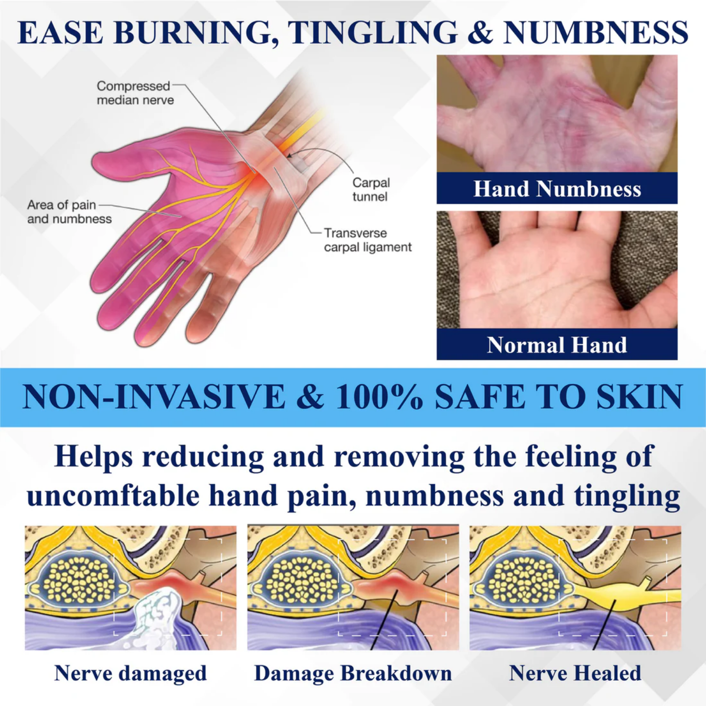 NovaRX® NerveRelief LC Medical Treatment Cream