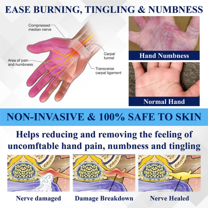 NovaRX® NerveRelief LC Medical Treatment Cream