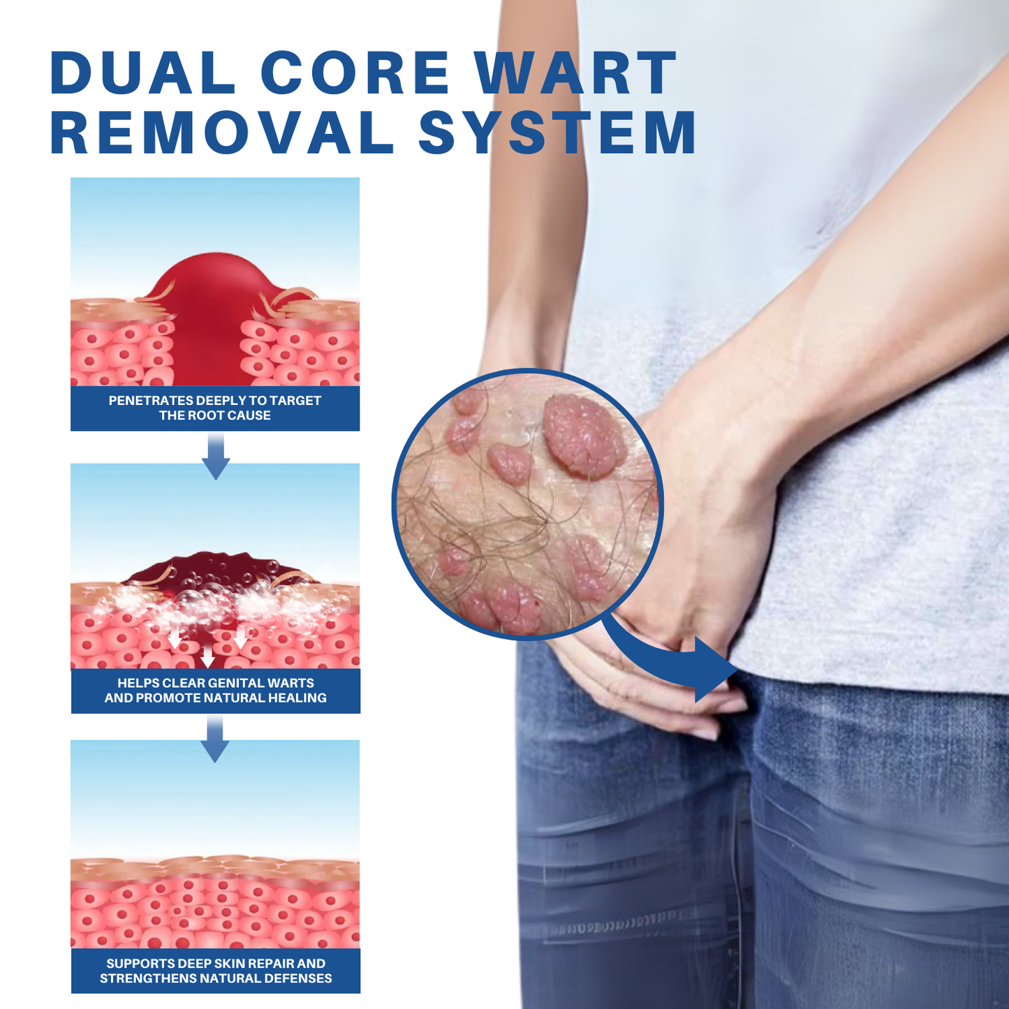 Fivfivgo® Advanced HPV & Rash Relief Genital Foam