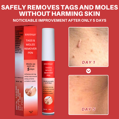Fivfivgo® Tags & Moles Remover Pen