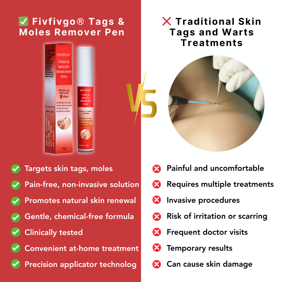 Fivfivgo® Tags & Moles Remover Pen