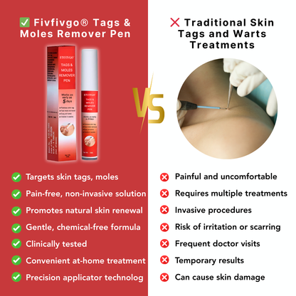 Fivfivgo® Tags & Moles Remover Pen
