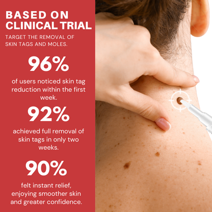 Fivfivgo® Tags & Moles Remover Pen