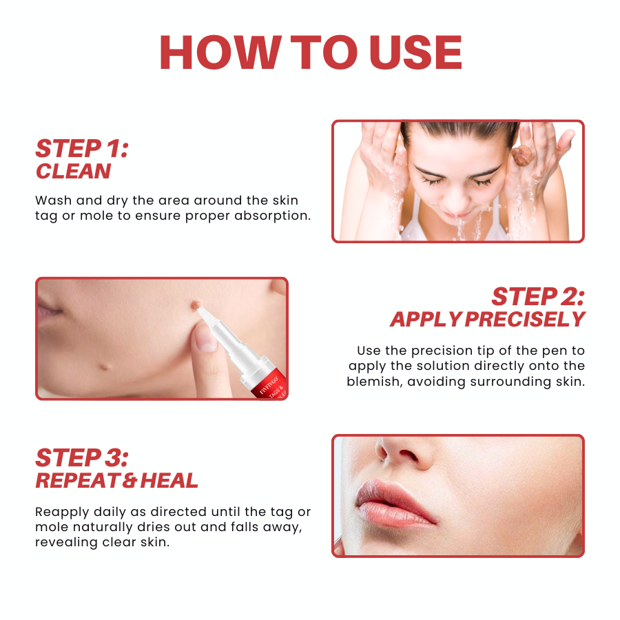 Fivfivgo® Tags & Moles Remover Pen