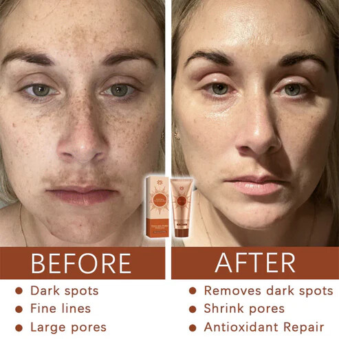 Fivfivgo® Herbal Spots Peel-Off Facial Mask Proxy