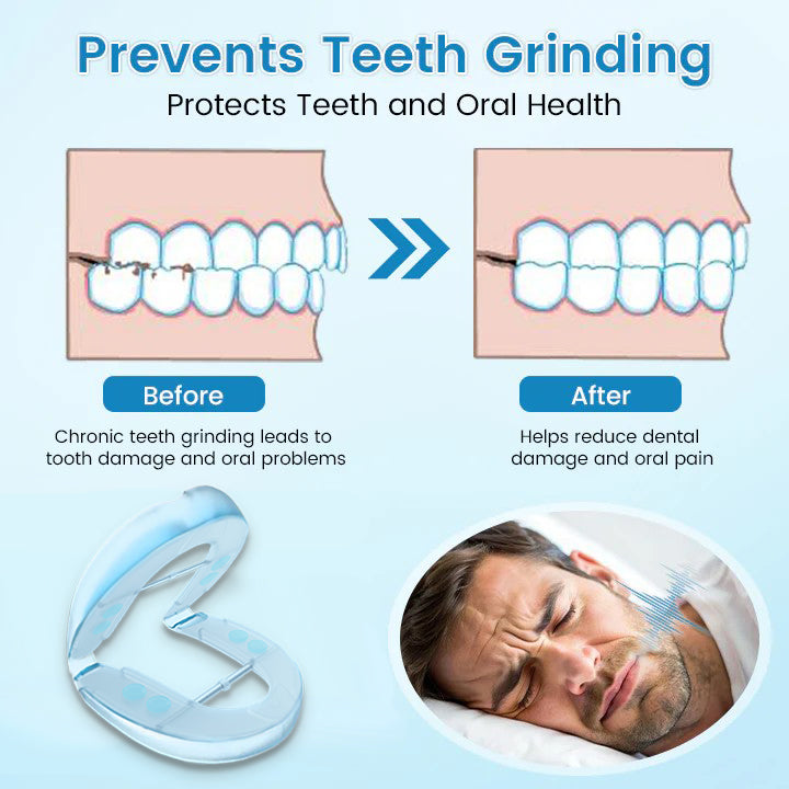 ✨Bikenda® DreamGuard: Anti-Snoring & Teeth Grinding Teeth Protector