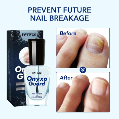 Fivfivgo® OnyxoGuard Nail Growth and Repair Serum