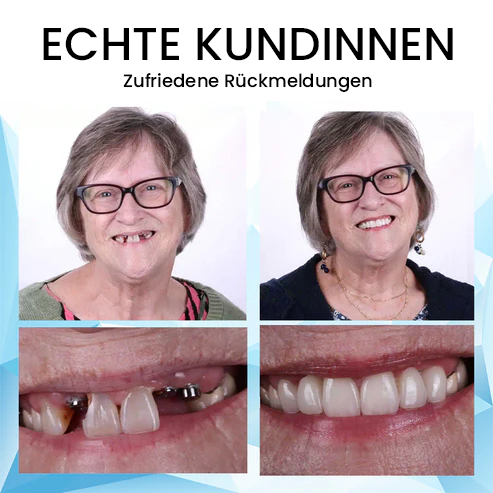 Oveallgo™ Siliconen Relining Prothese Set🦷