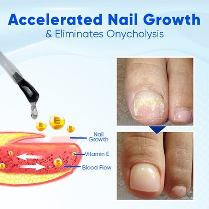 Fivfivgo® OnyxoGuard Nail Growth and Repair Serum